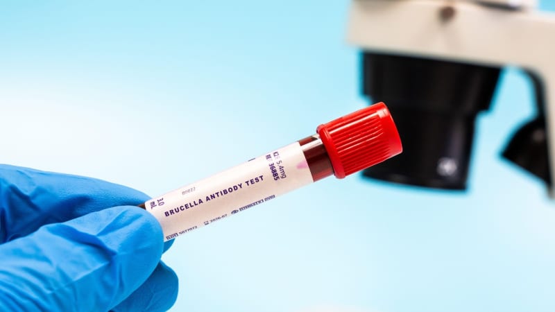 Nebezpečná brucelóza PŘEHLEDNĚ: Není to jen nemoc zvířat, může končit smrtí. Jaké jsou příznaky?